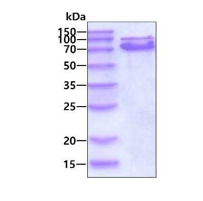 SDS-PAGE: Recombinant Human pan Cadherin His Protein [NBP2-52307]